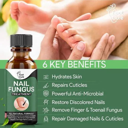 Nail Fungus Treatment Serum 10ml – Fast & Effective Fungal Solution