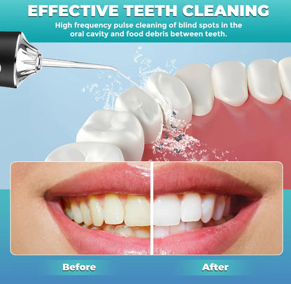 AquaSmile™ Portable Oral Irrigator