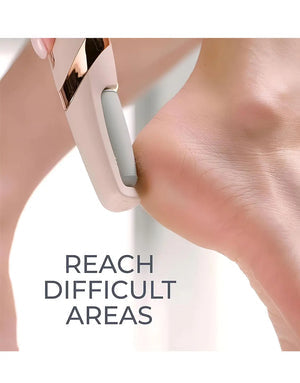 Rechargeable Electric Pedicure Foot File – Callus Remover for Hard & Dry Skin