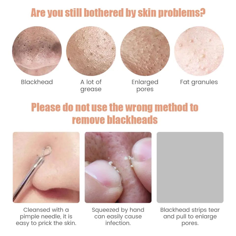 Electric Blackhead Remover, Pore Cleaner Machine